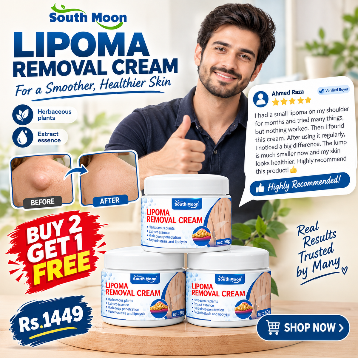 Lipoma Removal Cream Buy 1 Get 2 Free