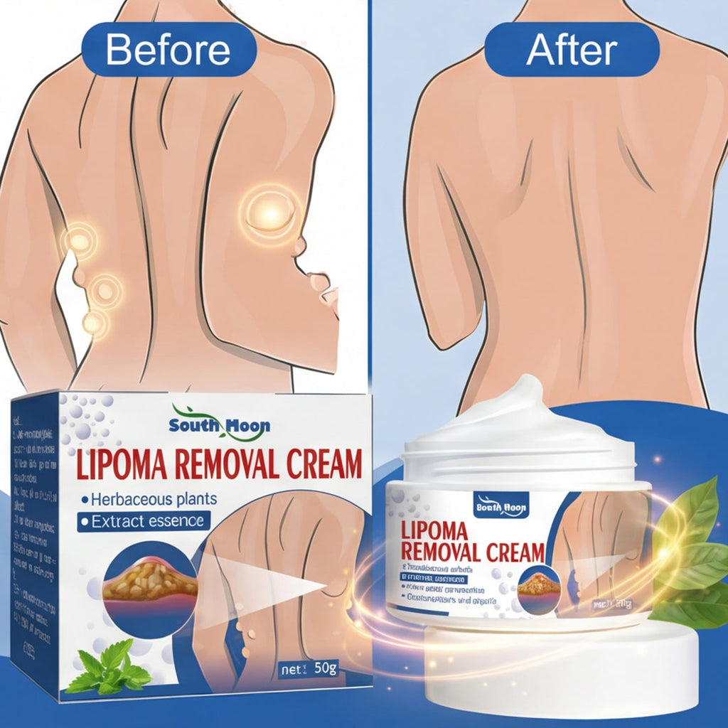 South Moon Lipoma Removal Cream