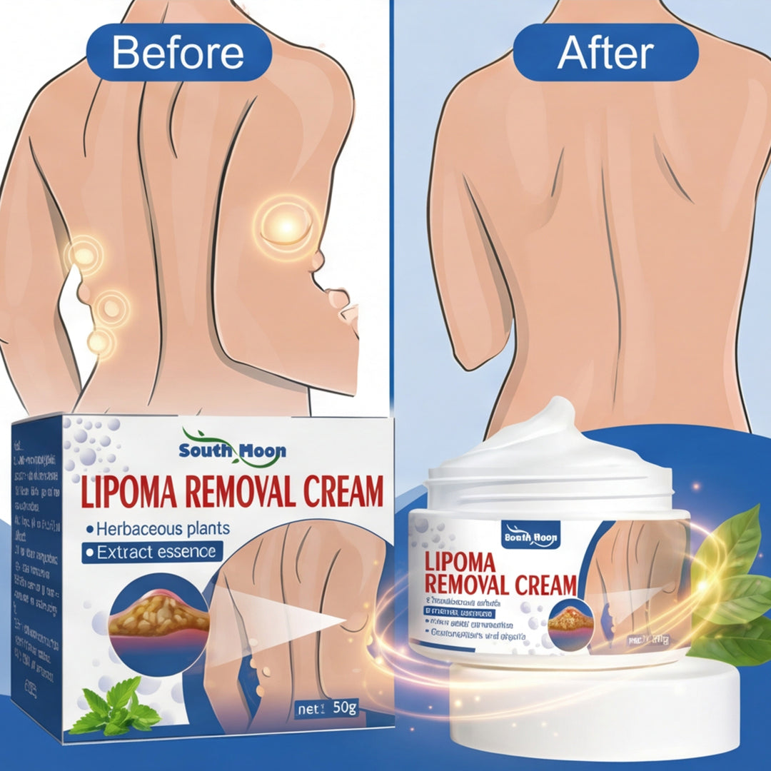South Moon Lipoma Removal Cream