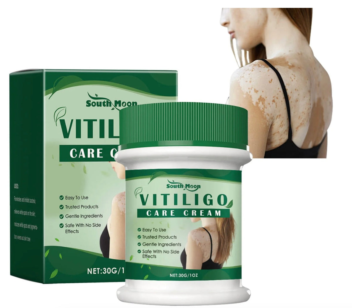 Vitiligo Herbal Cream